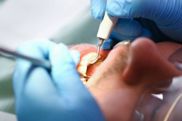 Best Emergency Orthodontic Services in Rossville, GA
