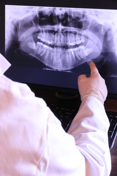 Best Emergency Dental Care for Broken or Chipped Teeth in Rossville, GA