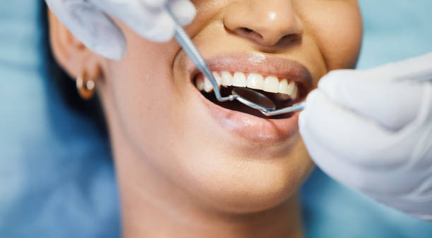 Best Emergency Dental Care for Broken or Chipped Teeth in Rossville, GA